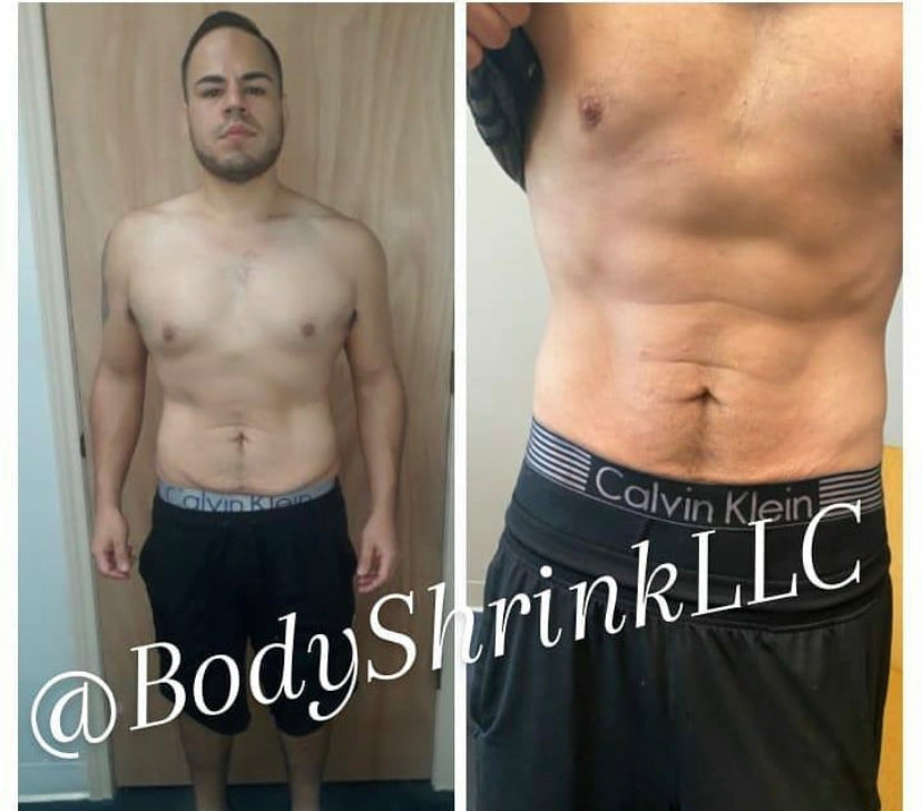 Body Shrinker Non-Invasive Laser Liposuction Session