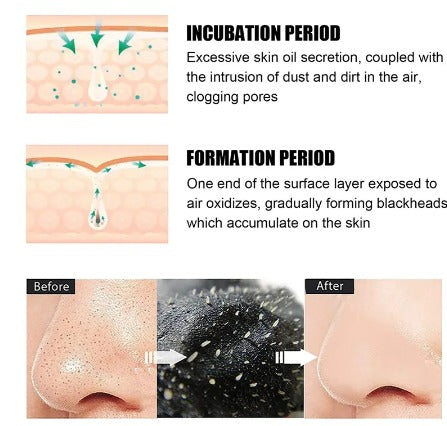 Blackhead Remover Mask Nasal Strips Black Head Nose Dot Spot Peel Off Sticker Face Acne Whitehead Pore Cleaner Mask Skin Care