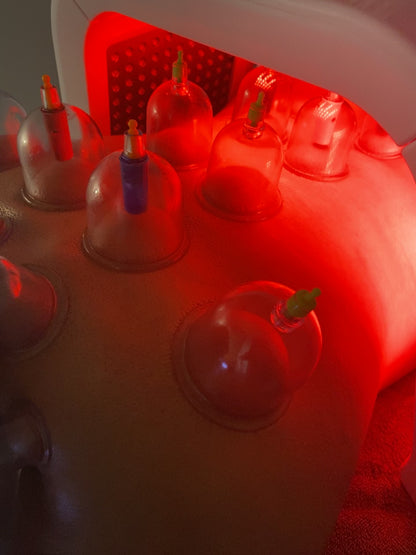 Cupping Therapy Session