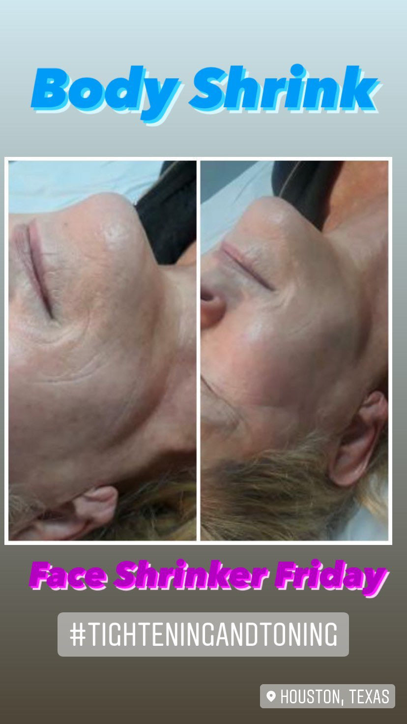 Cupping Therapy Session