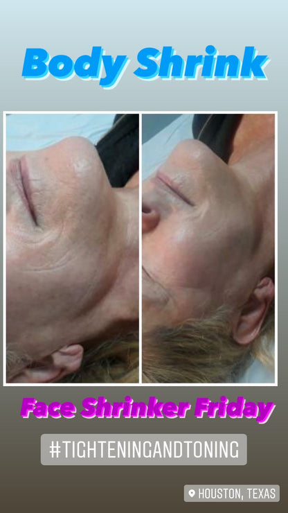 Cupping Therapy Session